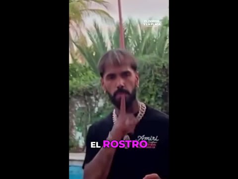 Anuel AA alarma a sus fans por drástico cambio en su apariencia | #elgordoylaflaca