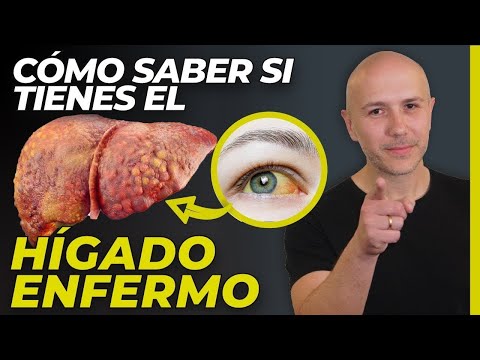 ¡SALVA TU HÍGADO! CONOCE LOS SIGNOS DE ALERTA Y MIS MEJORES RECOMENDACIONES | Dr. Carlos Jaramillo