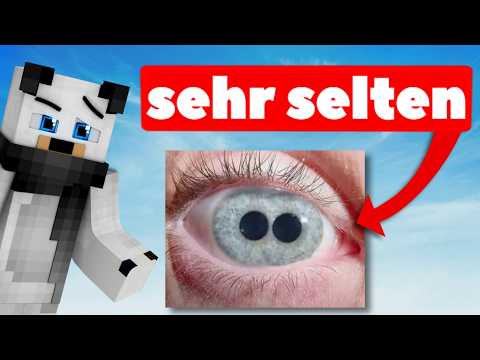 Do YOU ​​have these RARE body features?!