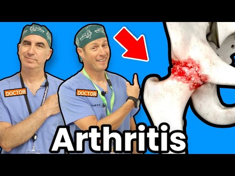 Treating Hip Arthritis Without Surgery