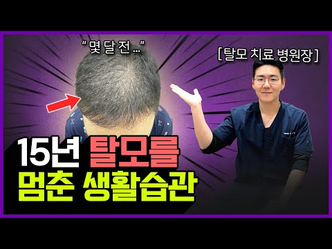 수술없이 탈모 극복한 후기