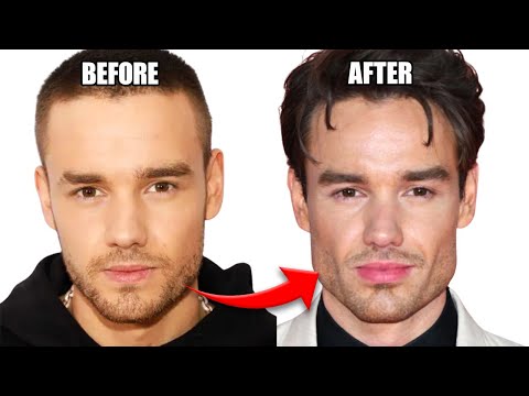 Liam Payne's New Face: Even the Experts Got This Wrong...