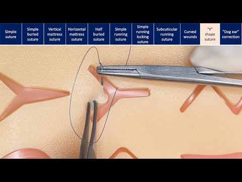 Suturing techniques