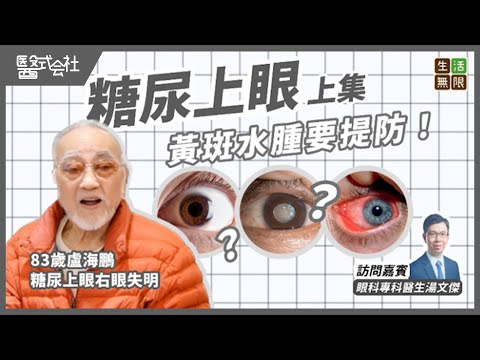 糖尿病引致「糖尿上眼」？(上集)｜盧海鵬糖尿上眼右眼失明｜黃斑水腫治療方法｜#醫式会社(第14集) #視力模糊 #飛蚊症 #青光眼 #白內障 #糖尿上眼食療 #盲 #失明 #podcast