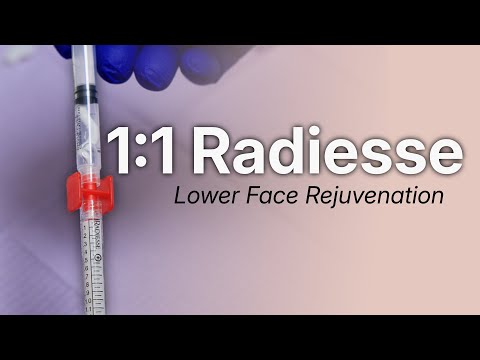 Step-by-Step Guide: Mixing Hyperdilute Radiesse | Part One