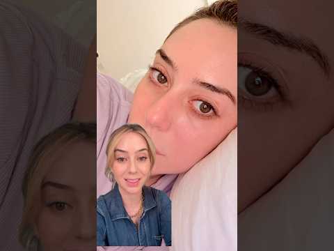 Can Lasers Make Melasma Worse? Here’s What You NEED to Know #shorts