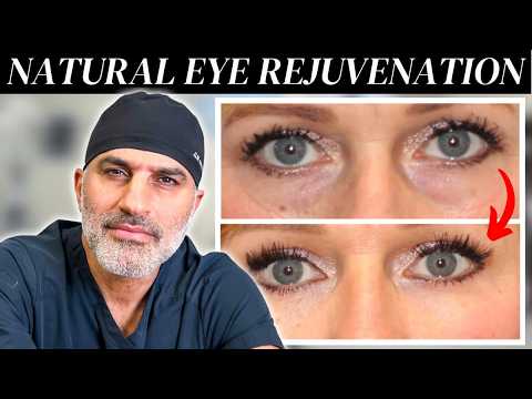 How to Surgically Rejuvenate Your Eyes Naturally (Without Looking fake)