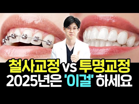 치아교정 고민 끝. 2025년 최신 기준, '이것' 하나만 보고 결정하세요 (비용, 기간, 장치 총정리)