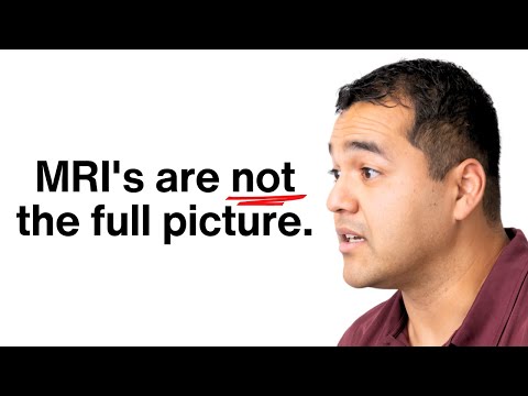 31 Minutes of Brutally Honest Advice for Healing a Meniscus Tear