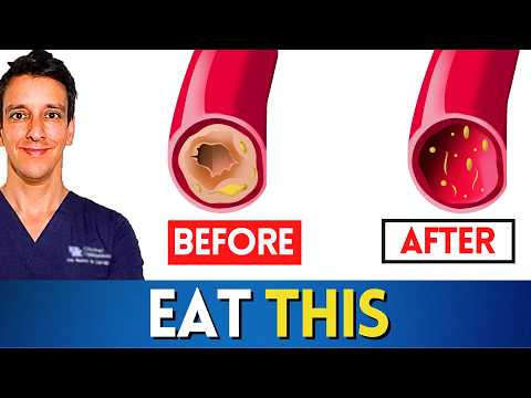 #1 Meal to Unclog Arteries (I´d give it to my own father)