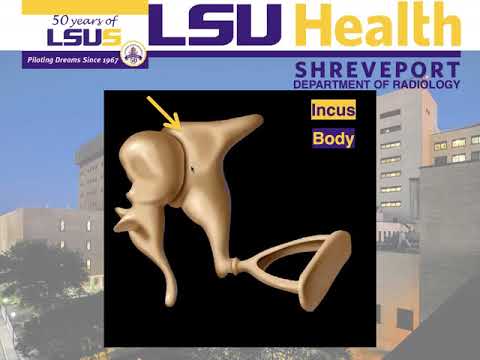HOW TO READ A TEMPORAL BONE CT - TEMPORAL BONE MADE RIDICULOUSLY SIMPLE