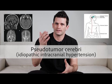 Pseudotumor cerebri (idiopathic intracranial hypertension)