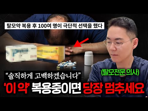 탈모에 걸린 의사가 절대 먹지 않는 탈모약