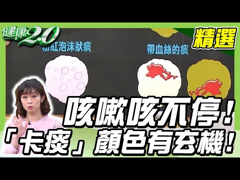 咳嗽咳不停！小心妳的「卡痰」顏色有玄機！【健康2.0精選】