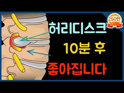[닥터홍선생]#20.허리디스크, 10분만에 평생 좋아지도록 해드립니다.