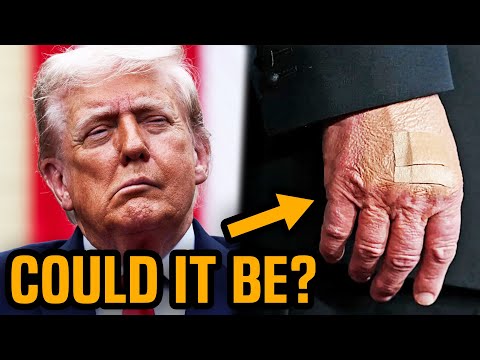 Rumor EXPLODES: Trump in treatment for Alzheimer’s?