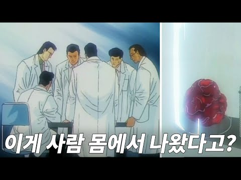 ❗약간 기괴함❗ 어떤 환자의 몸 속에서 나온 괴생명체