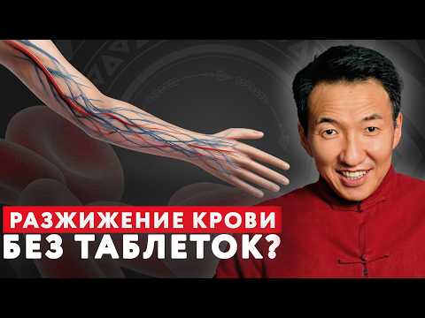 BLOOD THINNING at home WITHOUT PILLS – 5 simple tips! // #doctorZhimba