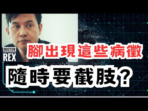 腳出現這些症狀隨時需要截肢？ 糖友必須千萬注意