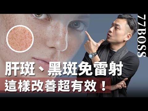 肝斑、黑斑如何去除？內調加外用，改善效果一級棒！【77老大】