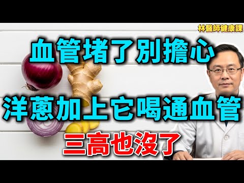 晚上睡不著，三高降不下？退休醫生教你：洋蔥加它煮，一覺睡天亮，血管也乾淨了！