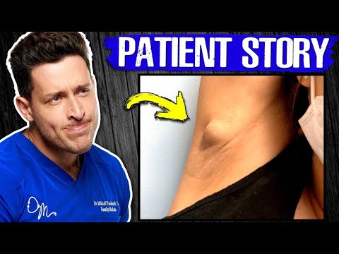 My Patient Thought it was Cancer…