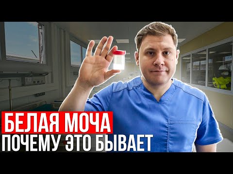 Белая моча. Почему так бывает.