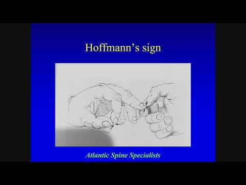 Evaluation and Management of Common Disorders of the Cervical Spine: Richard Nachwalter, MD
