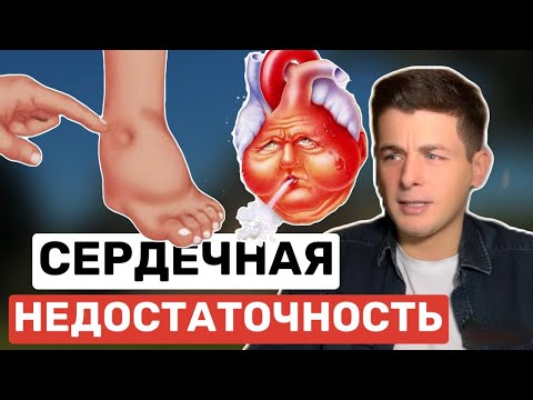 Сердечная недостаточность. Как понять, что она у вас есть и что делать!