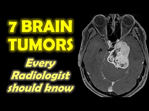 7 Brain Tumors every Radiologist should know