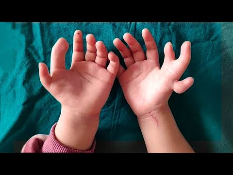 When People Were Born With Crazy Mutations