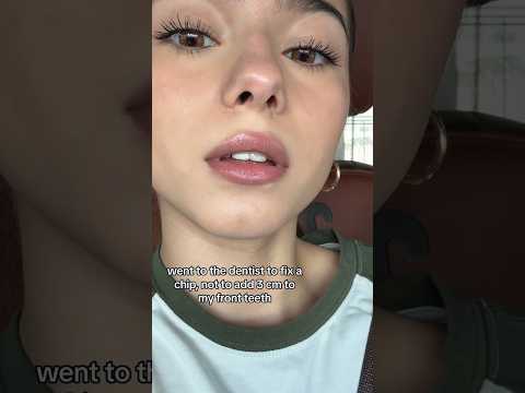 Why Small Tooth Chips Are EXTREMELY Hard To Fix!