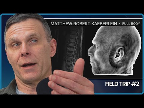 I Got a Full Body MRI: IS IT WORTH IT? I Share My Results