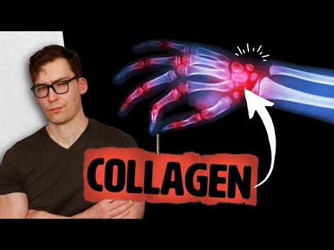 Collagen: Joint Pain Relief or Pointless Supplement?