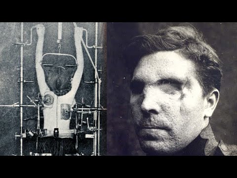 Edgewood Arsenal: CIA’s Experiments To Break A Man