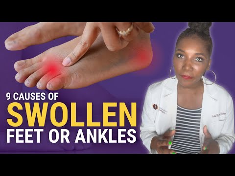 Foot and Ankle Swelling: 9 Dangerous Causes You Should NEVER Ignore!