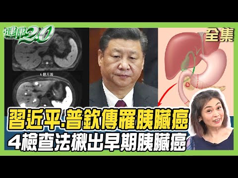 習近平 普欽 驚傳罹胰臟癌？ 5大胰臟癌高危險因子應篩檢 6大營養素養好胰臟！ 健康2.0 20240317【完整版】 鄭凱云 章明珠 王心儀 黃淑惠 洪素卿 雷議宗@tvbshealth20