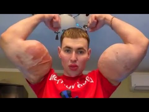 TikTok "Bodybuilder" Might Lose BOTH ARMS for "Looksmaxxing"..