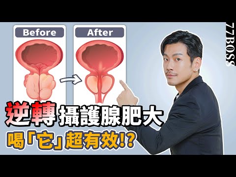 搶救攝護腺肥大，喝「它」超有效？能預防、能改善？重回滔天巨浪，就靠這一杯！【77老大】
