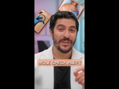 Mole Check Alert: Don’t Miss This Sign!