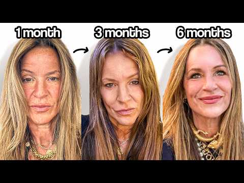 How I Transformed My 58 Year Old Mother (Naturally)