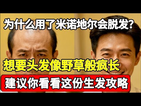 为什么用了米诺地尔会脱发？想要头发像野草般疯长，建议你看看这份生发攻略！【家庭大医生】