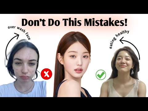 Stop These Common Acne Mistakes Now! ✨🔥 ( Or You'll Regret Later... )