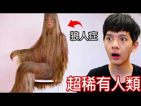 【尊】他們就是擁有0.001%罕見基因的「超稀有人類」! ? 下次進化可以記得帶上我嗎...? ?【第二頻道】