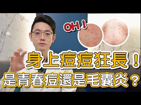 東抓抓西癢癢,遠離毛囊炎這些細節你有做到嗎?蕭全佑醫師告訴大家如何避免毛囊炎!