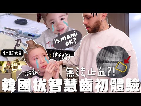 [VLOG] 見血⋯韓國開刀拔智慧齒@@!! 嚇哭女兒? 埋單$300港幣? 止血困難的原因？「吃軟雪糕?」 「千萬不能用飲管?」有用嗎｜Lizzy Daily