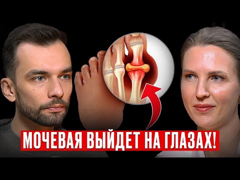 Мочевая выйдет на глазах