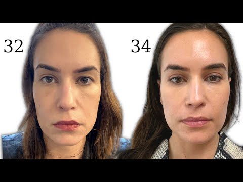 I spent $30,000 on anti-aging treatments - What's worth it?