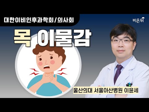 목 이물감 / [대한이비인후과학회/의사회] 울산의대 서울아산병원 이윤세