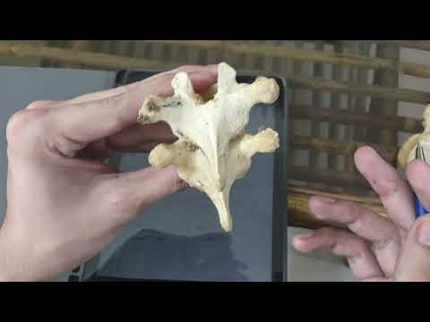 Thoracic Vertebrae Pedicle Screws